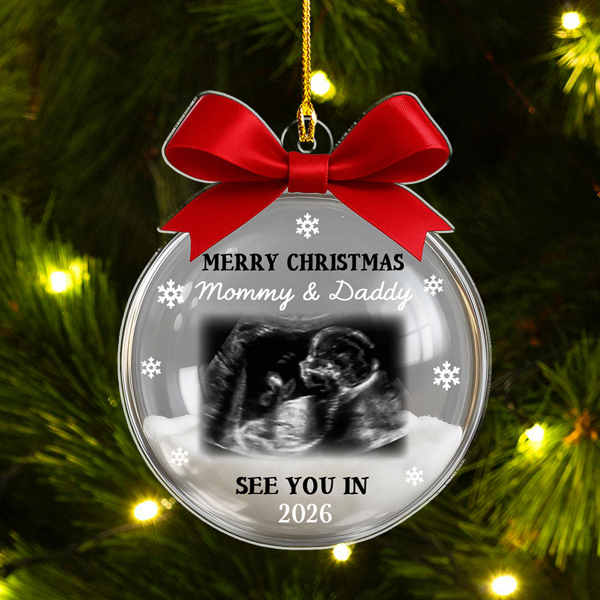 Custom Ultrasound Photo Baby Christmas Ornament for New Parents • Baby Expecting 2026 - Personalized Acrylic Ornament