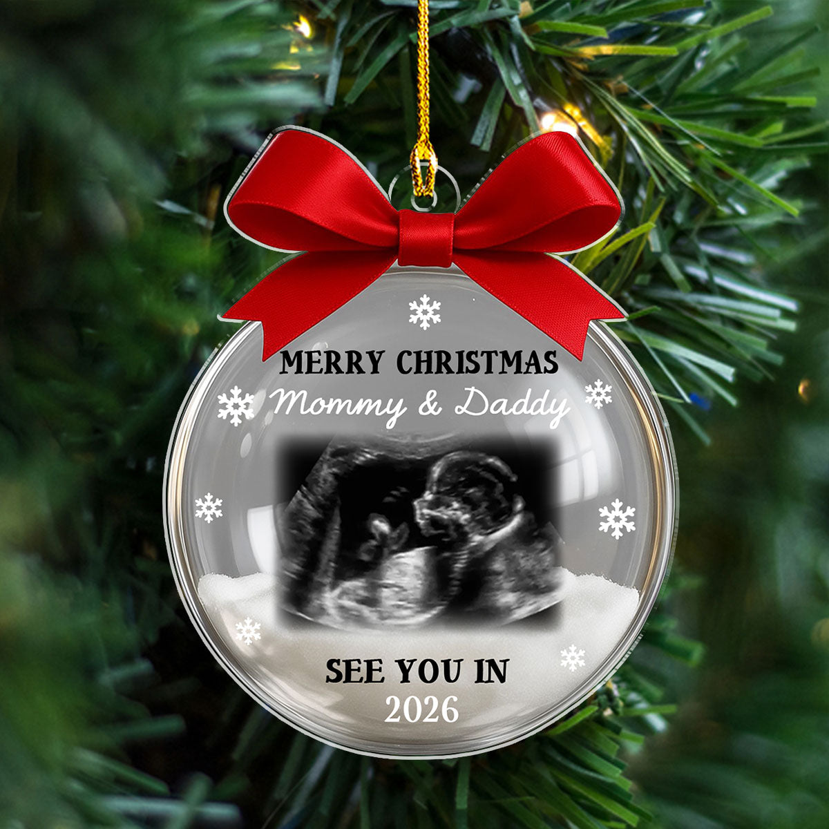 Custom Ultrasound Photo Baby Christmas Ornament for New Parents • Baby Expecting 2026 - Personalized Acrylic Ornament